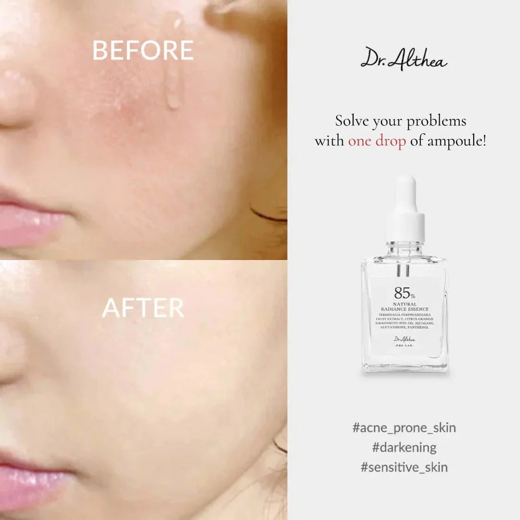 Dr.Althea Natural Radiance Essence serum in a 30ml bottle featuring a sleek design, from Lakinza K-beauty.