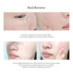 Dr.Althea Natural Radiance Essence serum bottle from Lakinza K-beauty, 30ml, with clear packaging and product labeling visible.