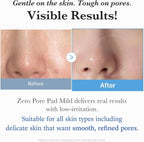 Medicube Zero Pore Serum 37ml