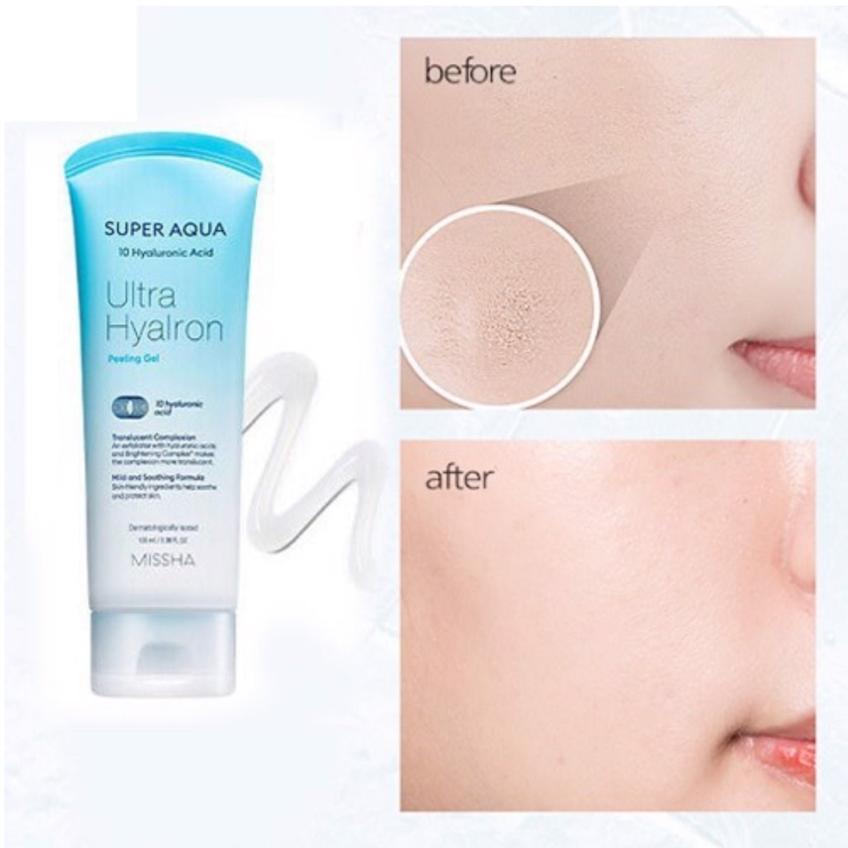 MISSHA Super Aqua Ultra Hyalron Peeling Gel cleanser in 100ml bottle, featuring hydrating and exfoliating ingredients by Lakinza K-beauty
