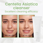 Lakinza Mixsoon Centella Cleansing Foam in 150ml tube, gentle facial cleanser with centella extract for soothing skin.