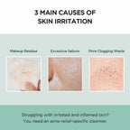 SKIN1004 Madagascar Centella Tea-Trica Purifying Toner 210ml in a clear bottle, suitable for Korean skincare routines.